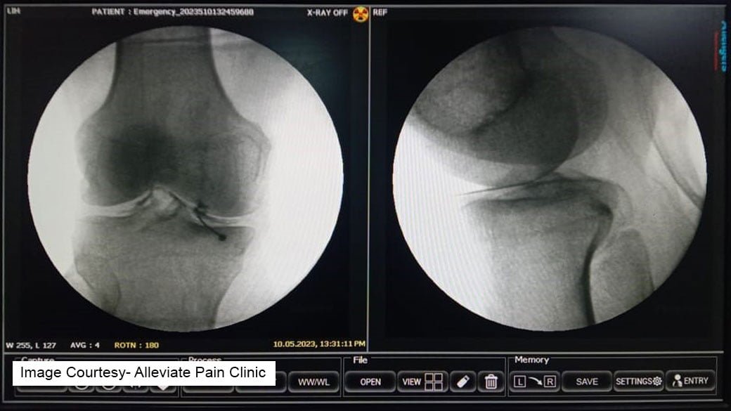 Knee pain img