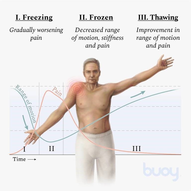 shoulder-pain