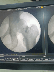 scanHip1