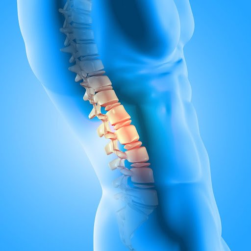 Common Causes for ruptured dics